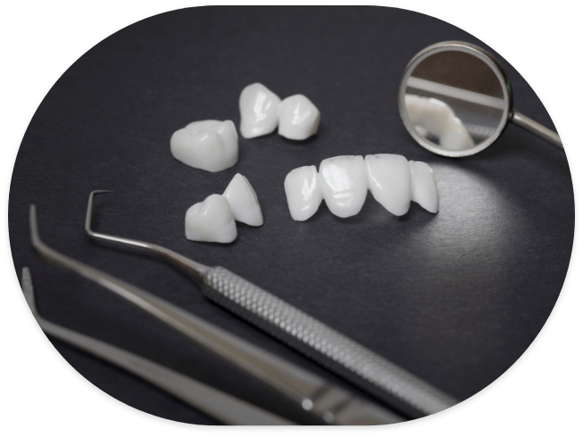 Several metal free dental veneers and crowns on tray with dental mirrors