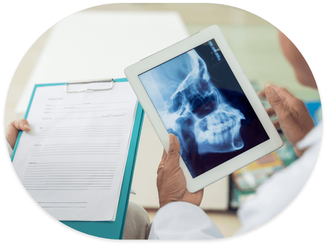 Person holding clipboard next to person holding tablet with X rays of jaw