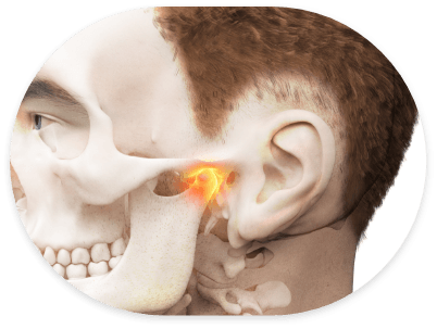 Illustrated side profile of face with jaw joint highlighted