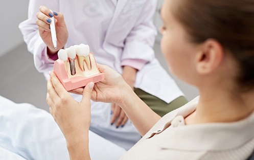 The first step to getting dental implants is the consultation