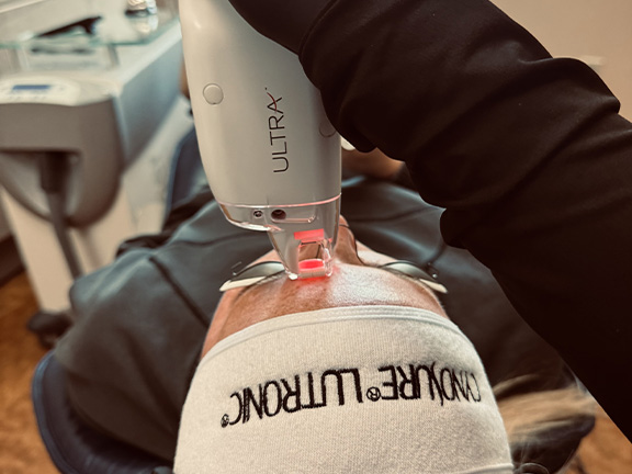 Woman receiving LASE MD Ultra treatment