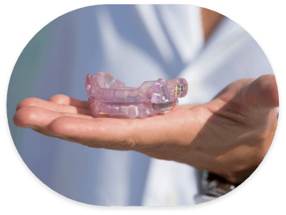 Hand holding light purple occlusal appliances for T M J treatment